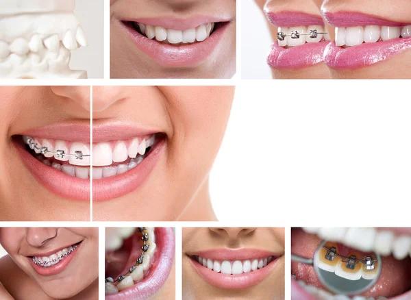 Professional Care From Thrive Dental and Orthodontics Dallas